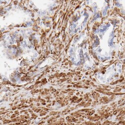 Filamin A Antibody, Novus Biologicals 25 &mu;L; Unlabeled:Antibodies, Polyclonal