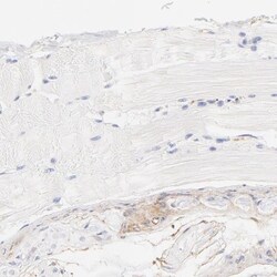 Filamin A Antibody, Novus Biologicals 25 &mu;L; Unlabeled:Antibodies, Polyclonal