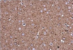 Filamin B Antibody (1372), Novus Biologicals 0.1mL; Unlabeled:Antibodies,