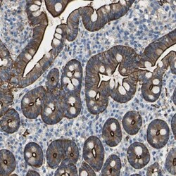Filamin B Antibody, Novus Biologicals 0.1mL; Unlabeled:Antibodies, Polyclonal