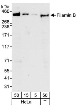 Filamin B Antibody, Novus Biologicals 0.1mL; Unlabeled:Antibodies, Polyclonal