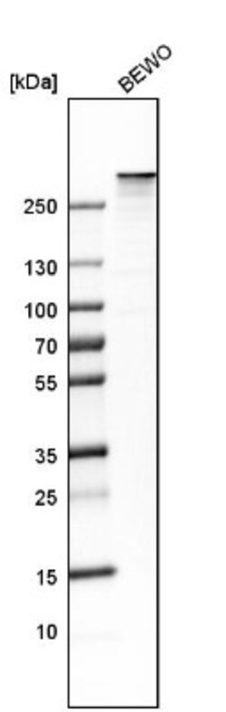 Filamin B Antibody, Novus Biologicals 0.1mL; Unlabeled:Antibodies, Polyclonal
