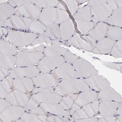 Flotillin 2 Antibody, Novus Biologicals 0.1mL; Unlabeled:Antibodies, Polyclonal