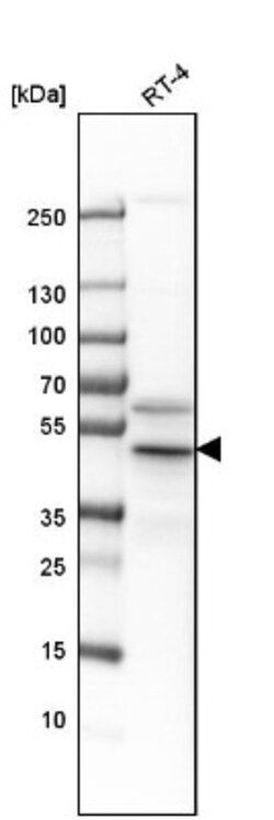 Flotillin 2 Antibody, Novus Biologicals 0.1mL; Unlabeled:Antibodies, Polyclonal