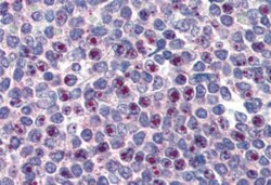 FoxC1 Antibody, Novus Biologicals 0.1 mg | Buy Online | Novus Biologicals | Fisher Scientific