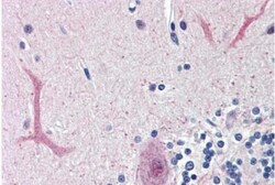 FoxC1 Antibody, Novus Biologicals 0.1 mg | Buy Online | Novus Biologicals | Fisher Scientific