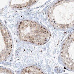 FoxC1 Antibody, Novus Biologicals 25 &mu;L; Unlabeled:Antibodies, Polyclonal