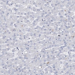 FoxC1 Antibody, Novus Biologicals 25 &mu;L; Unlabeled:Antibodies, Polyclonal