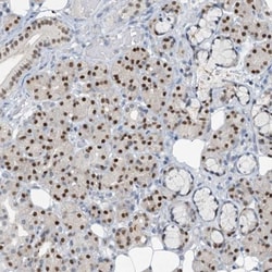 FoxC1 Antibody, Novus Biologicals 25 &mu;L; Unlabeled:Antibodies, Polyclonal