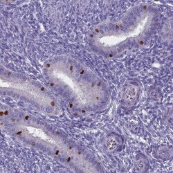 FoxJ1/HFH4 Antibody, Novus Biologicals 0.1mL; Unlabeled:Antibodies, Polyclonal