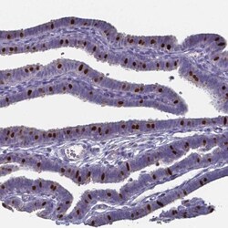 FoxJ1/HFH4 Antibody, Novus Biologicals 0.1mL; Unlabeled:Antibodies, Polyclonal