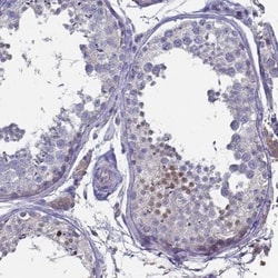 FoxJ1/HFH4 Antibody, Novus Biologicals 0.1mL; Unlabeled:Antibodies, Polyclonal