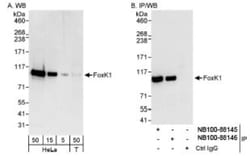 FoxK1 Antibody, Novus Biologicals 0.1mL; Unlabeled:Antibodies, Polyclonal