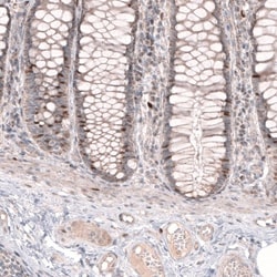 FoxM1 Antibody, Novus Biologicals 0.1mL; Unlabeled:Antibodies, Polyclonal