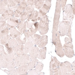 FoxM1 Antibody, Novus Biologicals 0.1mL; Unlabeled:Antibodies, Polyclonal