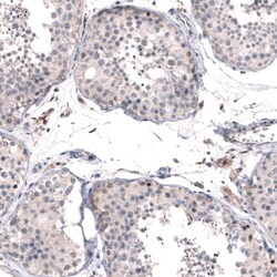 FoxM1 Antibody, Novus Biologicals 0.1mL; Unlabeled:Antibodies, Polyclonal