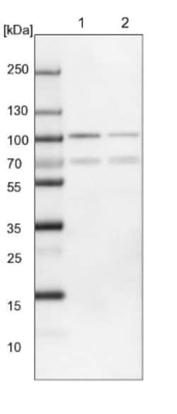 FoxP1 Antibody, Novus Biologicals:Antibodies:Primary Antibodies