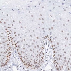 Melanotransferrin/CD228/MFI2 Antibody, Novus Biologicals:Antibodies:Primary