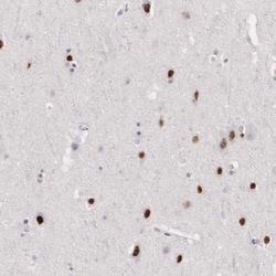 Melanotransferrin/CD228/MFI2 Antibody, Novus Biologicals:Antibodies:Primary