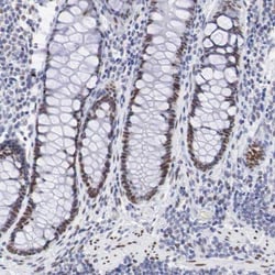 Melanotransferrin/CD228/MFI2 Antibody, Novus Biologicals:Antibodies:Primary