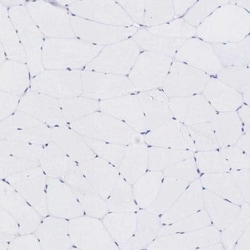 Melanotransferrin/CD228/MFI2 Antibody, Novus Biologicals:Antibodies:Primary