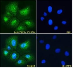 FoxP3 Antibody, Novus Biologicals 0.1mg; Unlabeled:Antibodies, Polyclonal