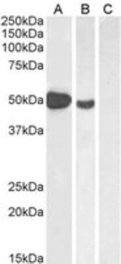 FoxP3 Antibody, Novus Biologicals 0.1mg; Unlabeled:Antibodies, Polyclonal