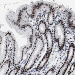 FoxP4 Antibody, Novus Biologicals 25 &mu;L; Unlabeled:Antibodies, Polyclonal