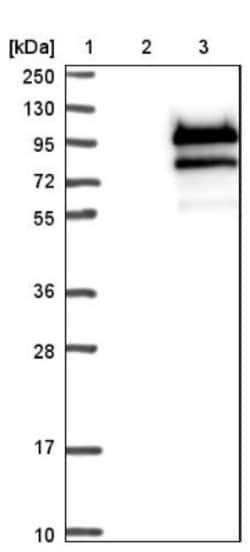 FoxP4 Antibody, Novus Biologicals 25 &mu;L; Unlabeled:Antibodies, Polyclonal