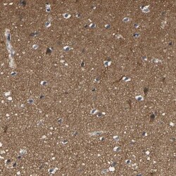 Frequenin Antibody, Novus Biologicals 0.1mL; Unlabeled:Antibodies, Polyclonal