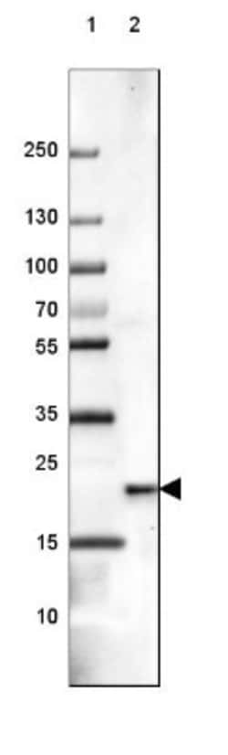 Frequenin Antibody, Novus Biologicals 0.1mL; Unlabeled:Antibodies, Polyclonal