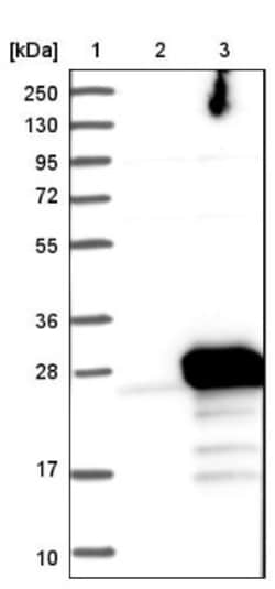 Frequenin Antibody, Novus Biologicals 0.1mL; Unlabeled:Antibodies, Polyclonal