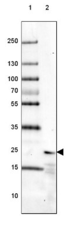 Frequenin Antibody, Novus Biologicals 0.1mL; Unlabeled:Antibodies, Polyclonal