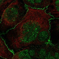 Frizzled-2 Antibody, Novus Biologicals 0.1mL; Unlabeled:Antibodies, Polyclonal