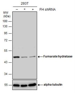 Fumarase Antibody, Novus Biologicals 100 &mu;L | Buy Online | Novus Biologicals | Fisher Scientific