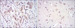 Fyn Antibody (2A10), Novus Biologicals 0.1mL; Unlabeled:Antibodies, Monoclonal