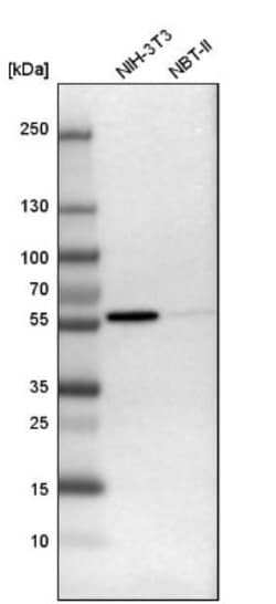 Fyn Antibody, Novus Biologicals:Antibodies:Primary Antibodies
