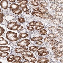 G protein alpha-13 Antibody, Novus Biologicals 25 &mu;L; Unlabeled:Antibodies,