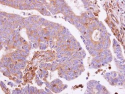 G protein alpha inhibitor 1 Antibody, Novus Biologicals 0.1mg; Unlabeled:Antibodies,