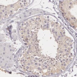G2E3 Antibody, Novus Biologicals 0.1mL; Unlabeled:Antibodies, Polyclonal