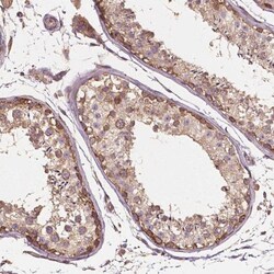 G3BP1 Antibody, Novus Biologicals:Antibodies:Primary Antibodies