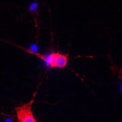G3BP2 Antibody, Novus Biologicals:Antibodies:Primary Antibodies