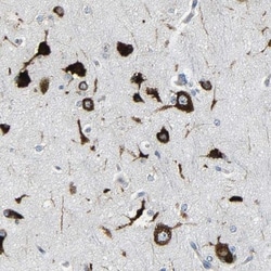 G3BP2 Antibody, Novus Biologicals:Antibodies:Primary Antibodies