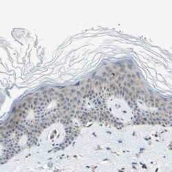 G3BP2 Antibody, Novus Biologicals:Antibodies:Primary Antibodies