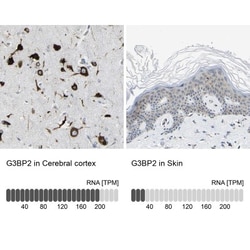 G3BP2 Antibody, Novus Biologicals:Antibodies:Primary Antibodies