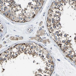 G3BP2 Antibody, Novus Biologicals:Antibodies:Primary Antibodies