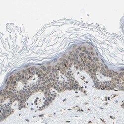 G3BP2 Antibody, Novus Biologicals:Antibodies:Primary Antibodies
