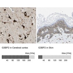 G3BP2 Antibody, Novus Biologicals:Antibodies:Primary Antibodies