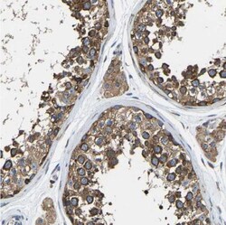 G3BP2 Antibody, Novus Biologicals:Antibodies:Primary Antibodies