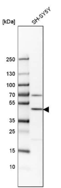 G3BP2 Antibody, Novus Biologicals:Antibodies:Primary Antibodies
